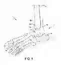 Fig. 02 - Alignment guide with embedded features for intra-operative fluoro-checks