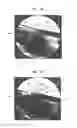Fig. 33 - Distal targeting device