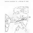 Fig. 01 - Determining and placing spinal implants or prostheses