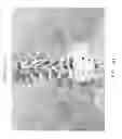 Fig. 02 - Determining and placing spinal implants or prostheses