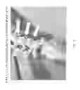 Fig. 04 - Determining and placing spinal implants or prostheses