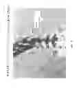 Fig. 05 - Determining and placing spinal implants or prostheses