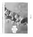 Fig. 06 - Determining and placing spinal implants or prostheses