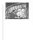 Fig. 13 - Determining and placing spinal implants or prostheses