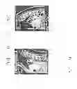 Fig. 14 - Determining and placing spinal implants or prostheses