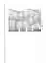 Fig. 16 - Determining and placing spinal implants or prostheses