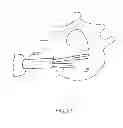 Fig. 25 - Determining and placing spinal implants or prostheses