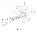 Fig. 26 - Determining and placing spinal implants or prostheses