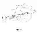 Fig. 27 - Determining and placing spinal implants or prostheses