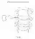 Fig. 29 - Determining and placing spinal implants or prostheses
