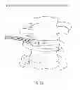 Fig. 30 - Determining and placing spinal implants or prostheses