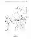Fig. 32 - Determining and placing spinal implants or prostheses