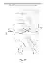 Fig. 33 - Determining and placing spinal implants or prostheses