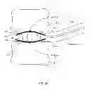 Fig. 37 - Determining and placing spinal implants or prostheses