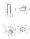 Fig. 05 - Surgical distance adjusting assembly for a bone distractor