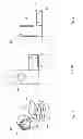 Fig. 12 - Surgical distance adjusting assembly for a bone distractor