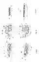 Fig. 13 - Surgical distance adjusting assembly for a bone distractor