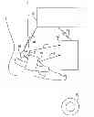 Fig. 01 - Minimally invasive implantable neurostimulation system