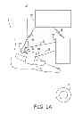 Fig. 02 - Minimally invasive implantable neurostimulation system