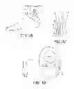 Fig. 03 - Minimally invasive implantable neurostimulation system