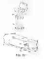 Fig. 18 - Minimally invasive implantable neurostimulation system