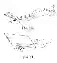 Fig. 24 - Minimally invasive implantable neurostimulation system