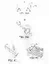 Fig. 27 - Minimally invasive implantable neurostimulation system
