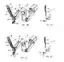 Fig. 07 - Telescoping insertion axis of a robotic surgical system