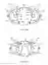Fig. 13 - System for tissue repair