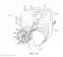 Fig. 16 - System for tissue repair