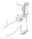 Fig. 01 - Systems for soft tissue repair