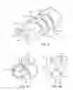 Fig. 04 - Systems for soft tissue repair
