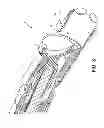 Fig. 04 - Device for cutting tissue