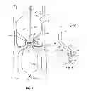 Fig. 02 - Shockwave catheter