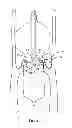 Fig. 03 - Shockwave catheter