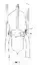 Fig. 04 - Shockwave catheter