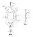 Fig. 05 - Shockwave catheter