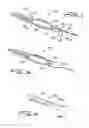 Fig. 02 - CUTTING WIRE ASSEMBLY FOR USE WITH A CATHETER