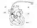 Fig. 01 - Methods and apparatus to increase secretion of endogenous naturetic hormones