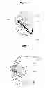 Fig. 02 - Methods and apparatus to increase secretion of endogenous naturetic hormones