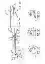 Fig. 02 - Systems and methods for treating a vessel using focused force