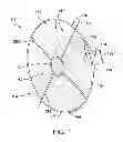 Fig. 02 - Methods and apparatus for capturing embolic debris during endovascular procedures
