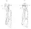 Fig. 01 - POSTURE CORRECTING TOOL