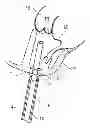 Fig. 01 - Collapsible Medical Closing Device, A Method And A Medical System For Delivering An Object