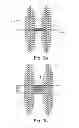 Fig. 03 - Collapsible Medical Closing Device, A Method And A Medical System For Delivering An Object
