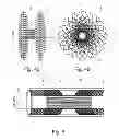 Fig. 04 - Collapsible Medical Closing Device, A Method And A Medical System For Delivering An Object