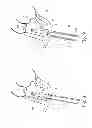 Fig. 06 - Collapsible Medical Closing Device, A Method And A Medical System For Delivering An Object