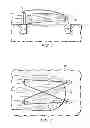 Fig. 02 - NOVEL SUTURE