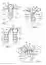 Fig. 02 - Method and apparatus for soft tissue fixation