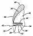 Fig. 01 - Anchor driver with suture clutch